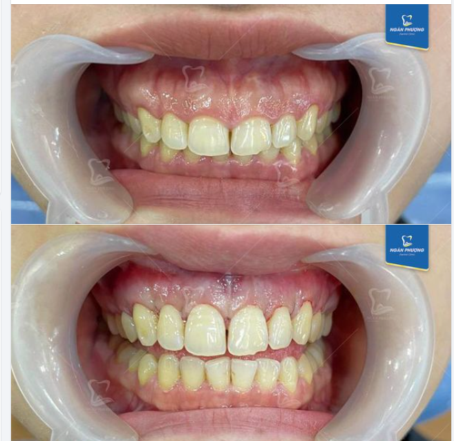 30 năm chỉ đợi khoảnh khắc này