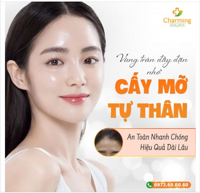 CẤY MỠ TRÁN - PHƯƠNG PHÁP HIỆU QUẢ ĐỂ NÍU KÉO TUỔI XUÂN