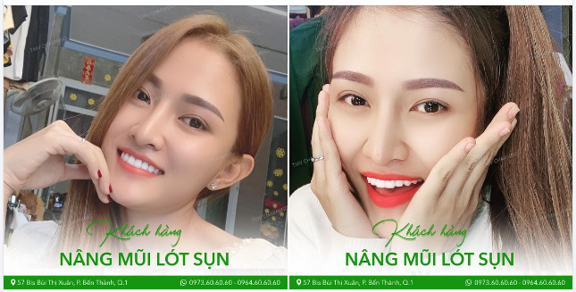 Nhìn nàng tươi tắn mà Charming cũng thấy vui lây