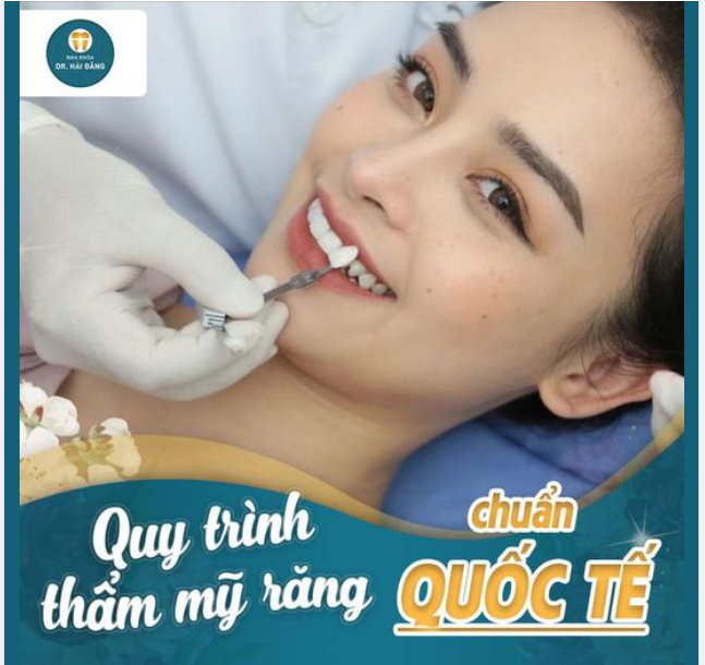 Quy trình thẩm mỹ răng sứ chuẩn quốc tế