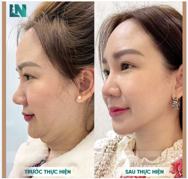 Có được góc nghiêng hoàn hảo là mơ ước của các chị em ở đây đúng không?