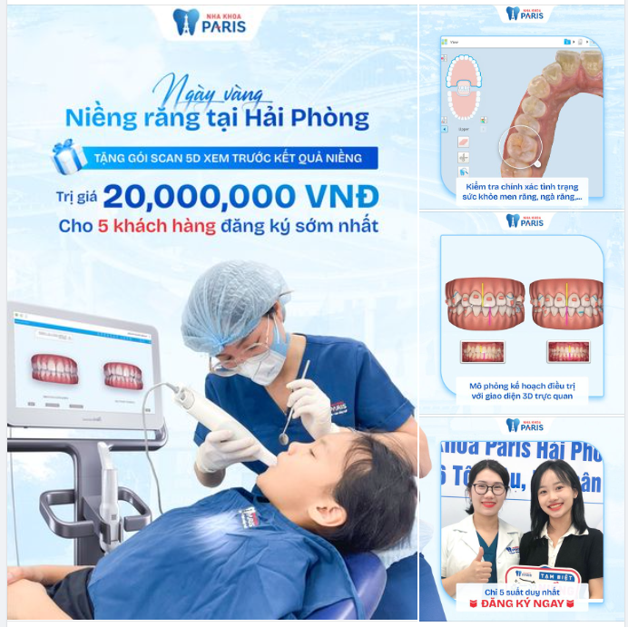 NGÀY HỘI SCAN RĂNG - Tặng 25 % chi phí chỉnh nha
