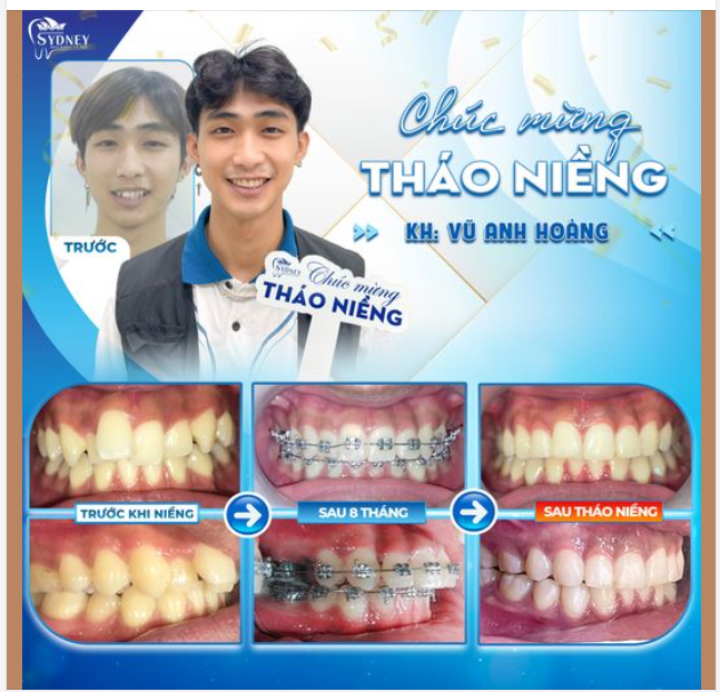 CHÚC MỪNG THÁO NIỀNG KH. VŨ HOÀNG