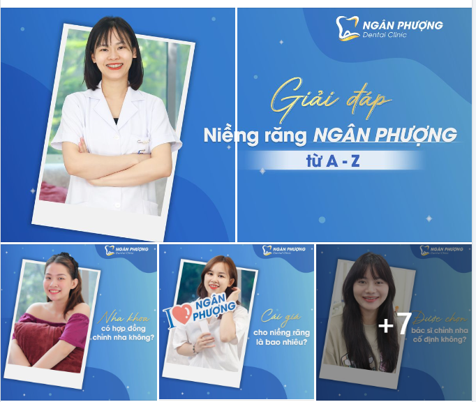 1001 câu hỏi thường gặp của đồng niềng