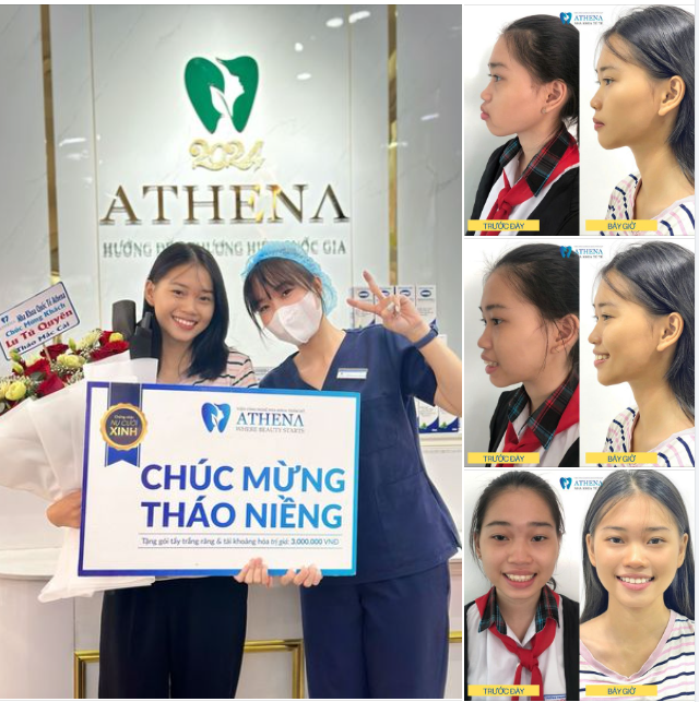 Niềng răng có thật sự thay đổi thẩm mỹ khuôn mặt không?