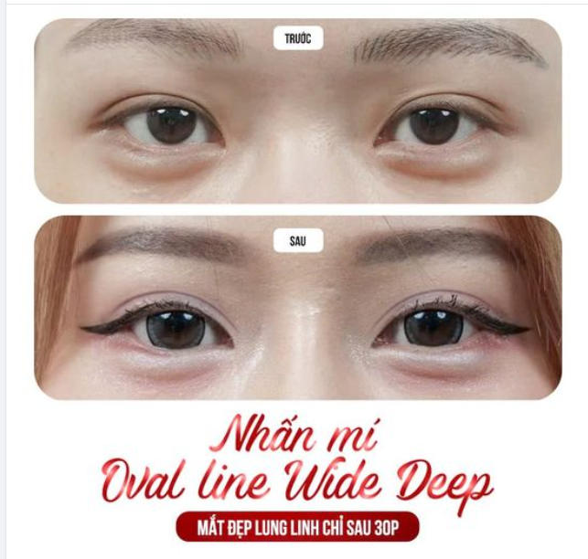 Sở hữu ĐÔI MẮT TO TRÒN CUỐN HÚT chỉ sau 30 phút