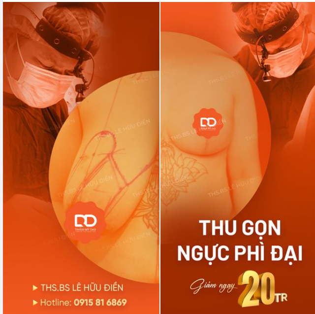 THU GỌN PHÌ ĐẠI GIẢM NGAY 20TR.