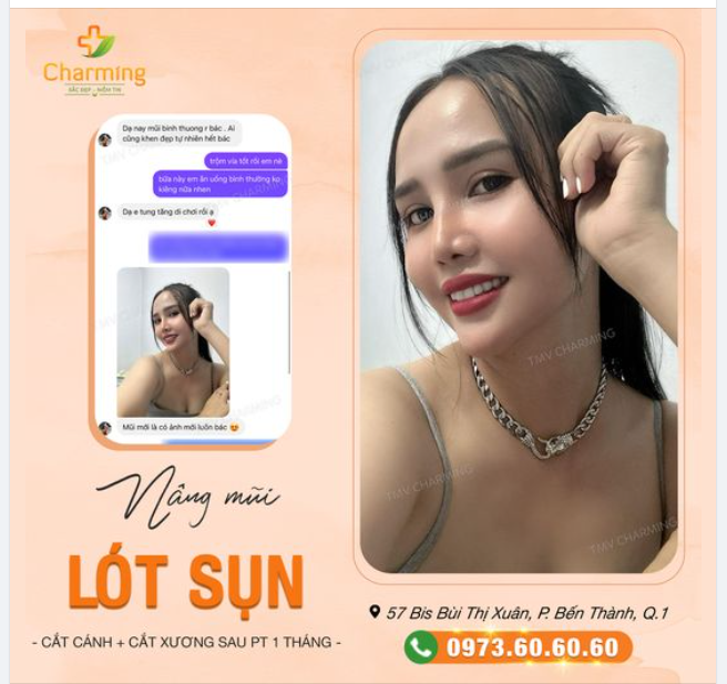 Nhìn nàng khách đã nâng mũi lót sụn, cắt xương kết hợp cắt cánh mũi tại Charming tự tin như hiện tại là một niềm tự hào, vinh hạnh to lớn của Charming luôn