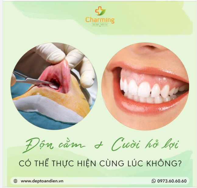 ĐỘN CẰM VÀ CHỈNH CƯỜI HỞ LỢI CÓ THỂ THỰC HIỆN CÙNG LÚC KHÔNG?