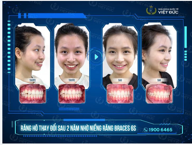 ĐẸP THẾ NÀY, NGẠI GÌ KHÔNG CƯỜI