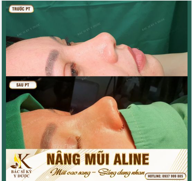 Nhược điểm hóa ưu điểm - Nâng thần thái cao sang