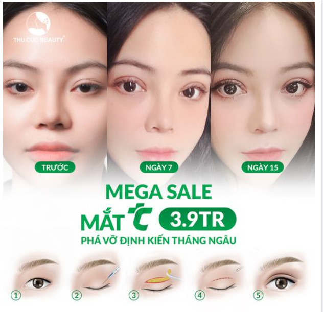 Cắt mí xinh với giá siêu hời chỉ duy nhất 3 ngày 8-9-10/8 > Mắt TC 3.9Tr