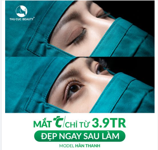 Tối ưu chi phí cắt mí giá gốc chỉ từ 3.9Tr. Ưu đãi giảm giá sâu trong tháng Ngâu - Duy nhất 8-9-10/8 Đặt lịch ngay