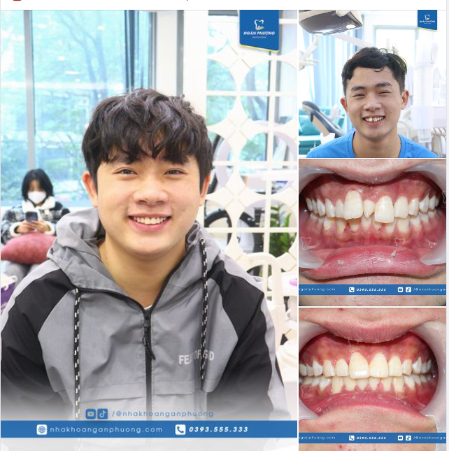 Khi phép màu là tên gọi khác của sự nỗ lực