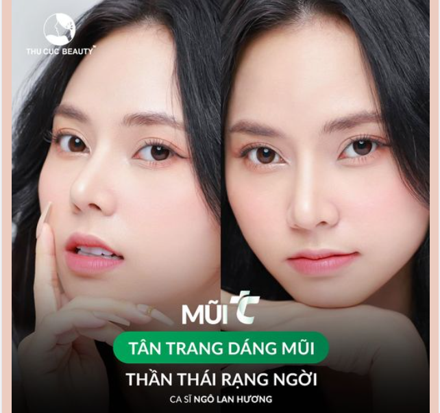 Nâng mũi TC Bí quyết để sở hữu lỗ mũi hạt chanh, hài hòa gương mặt?