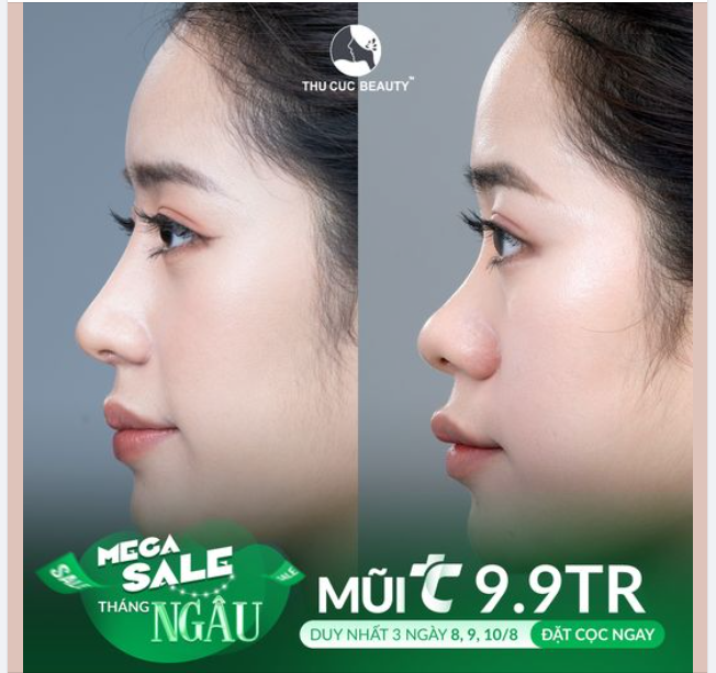 Chỉ sau 30 phút thực hiện. Khuôn mặt chuẩn tỉ lệ vàng