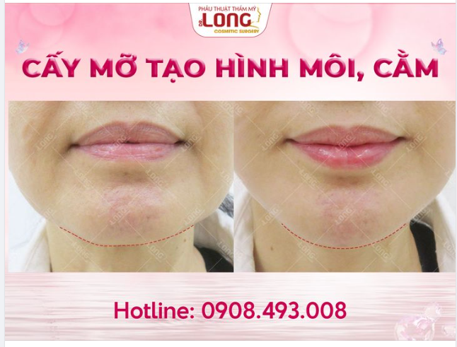 KHUYẾT ĐIỂM Ở ĐÂU MÌNH CHỈNH Ở ĐÓ!