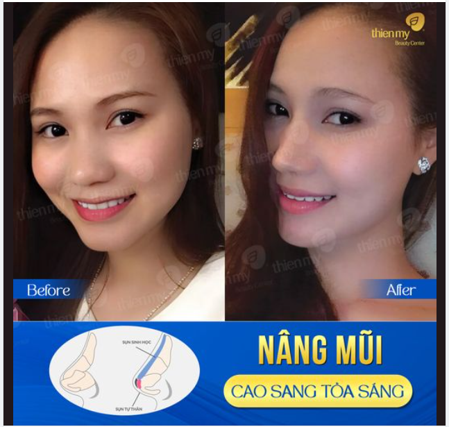 Khách xinh, mũi xinh, và mỗi ngày đều lung linh hơn!