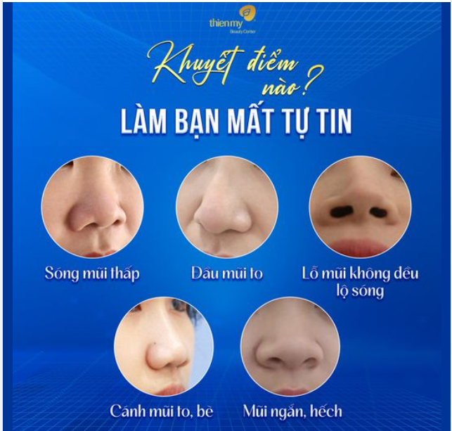 Khuyết điểm nào khiến bạn mất tự tin?