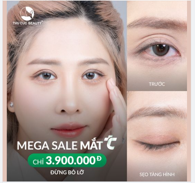 MEGA SALE Tháng Ngâu - Ưu đãi Mắt TC 9TR nay chỉ còn 3.9TR