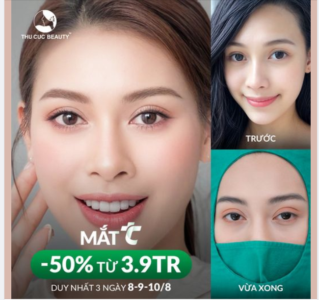 Sở hữu những ưu điểm vượt trội, giúp bạn sở hữu một đôi mắt tròn đẹp, tự nhiên