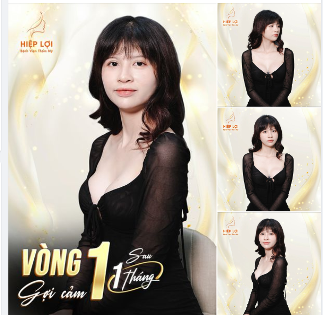 Ngắm nhan sắc cực "slay" sau "1 tháng" của khách yêu nâng ngực tại BVTM Hiệp Lợi
