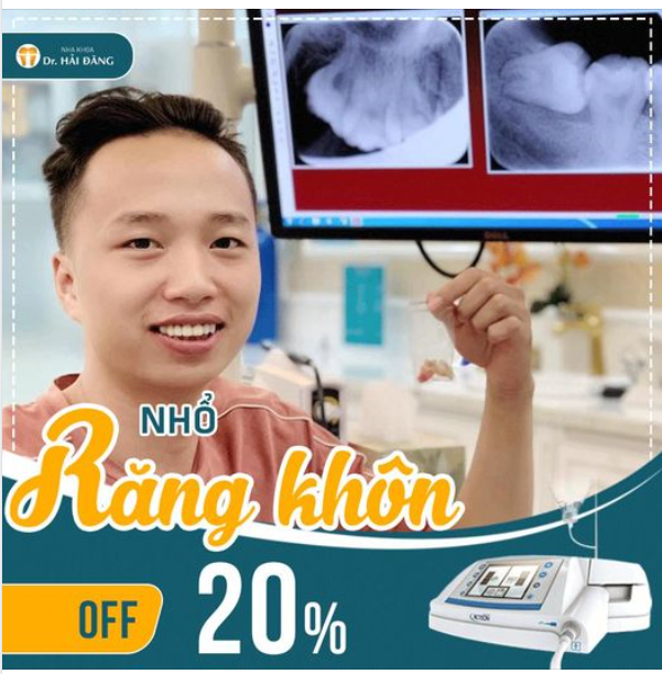 NHỔ RĂNG KHÔN ƯU ĐÃI LỚN