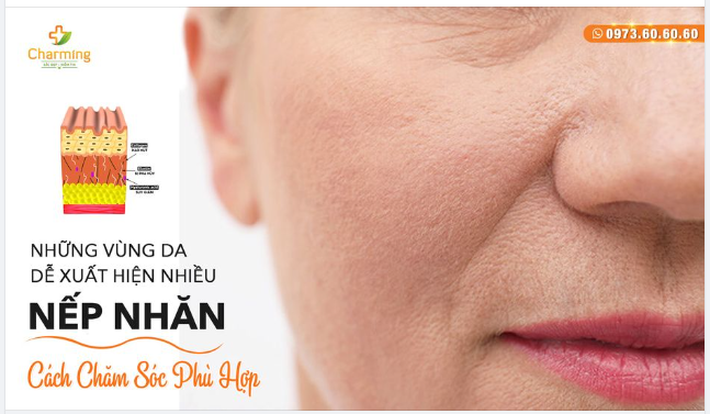 NHỮNG VÙNG DA DỄ XUẤT HIỆN NẾP NHĂN VÀ CÁCH CHĂM SÓC PHÙ HỢP