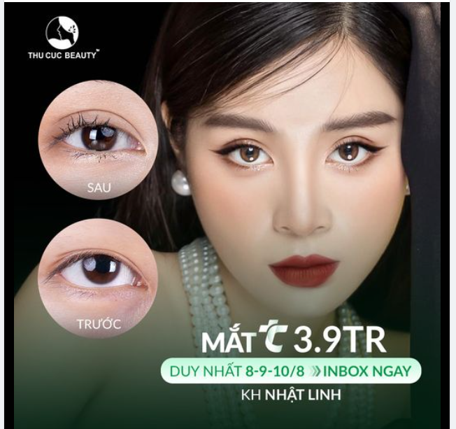 Ngày vàng cắt mí TC ngay thôi