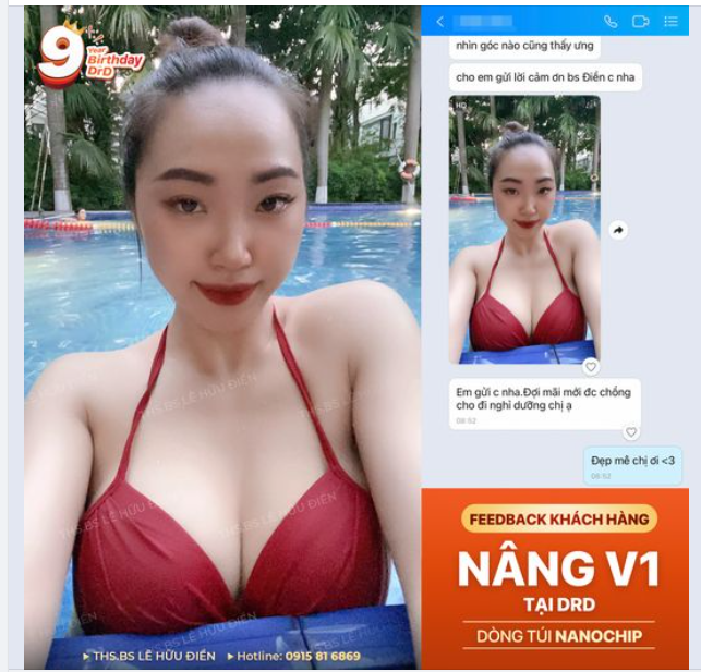 TỰ TIN ĐÓN HÈ VỚI V1 CĂNG TRÒN TỰ NHIÊN.