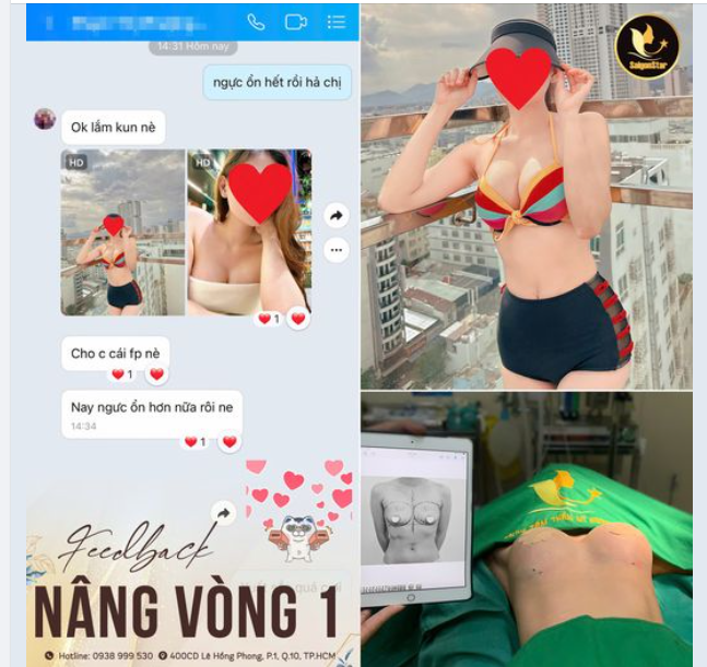 MỘT CHIẾC FEEDBACK GÂY THƯƠNG NHỚ SAU KHI NÂNG CẤP NÂNG VÒNG 1 TẠI SAIGON STAR!