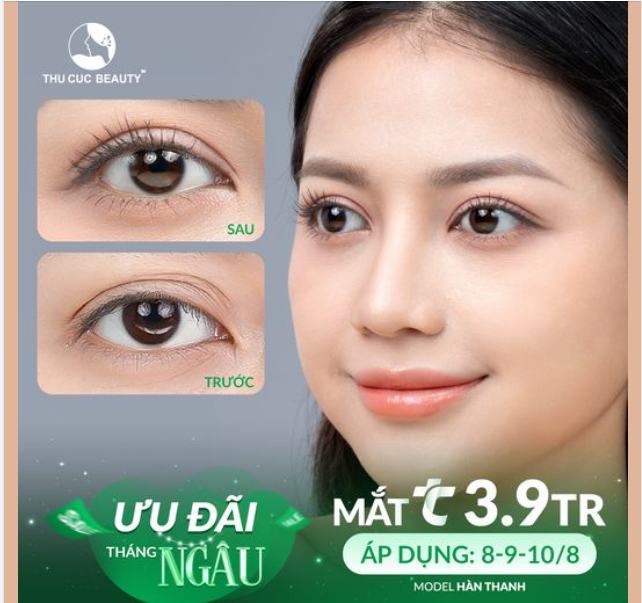 Cắt mí chỉ từ 3.9TR Ưu đãi dành cho những chị em muốn sở hữu nếp mí to tròn