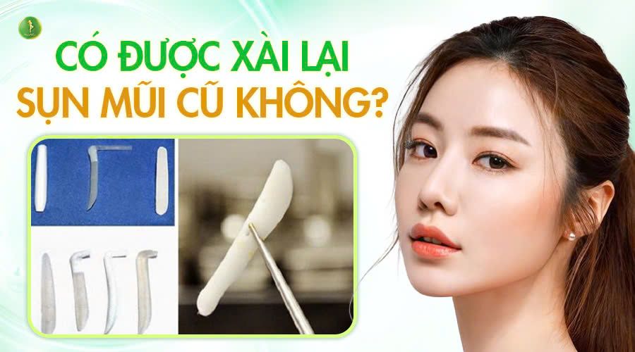 CÓ ĐƯỢC XÀI LẠI SỤN MŨI CŨ KHÔNG?