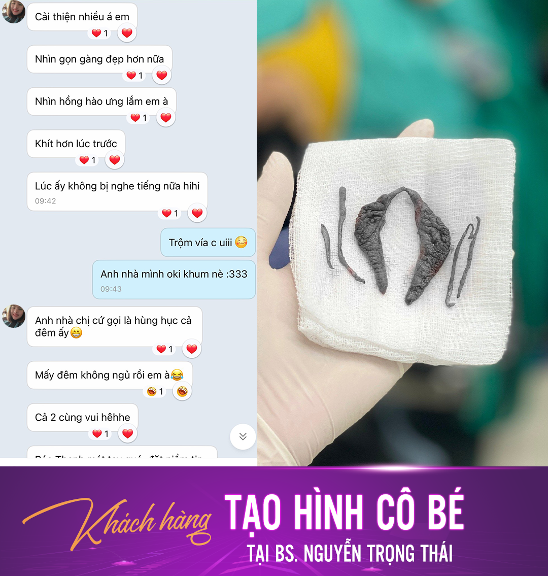 Feedback của BS Nguyễn Trọng Thái