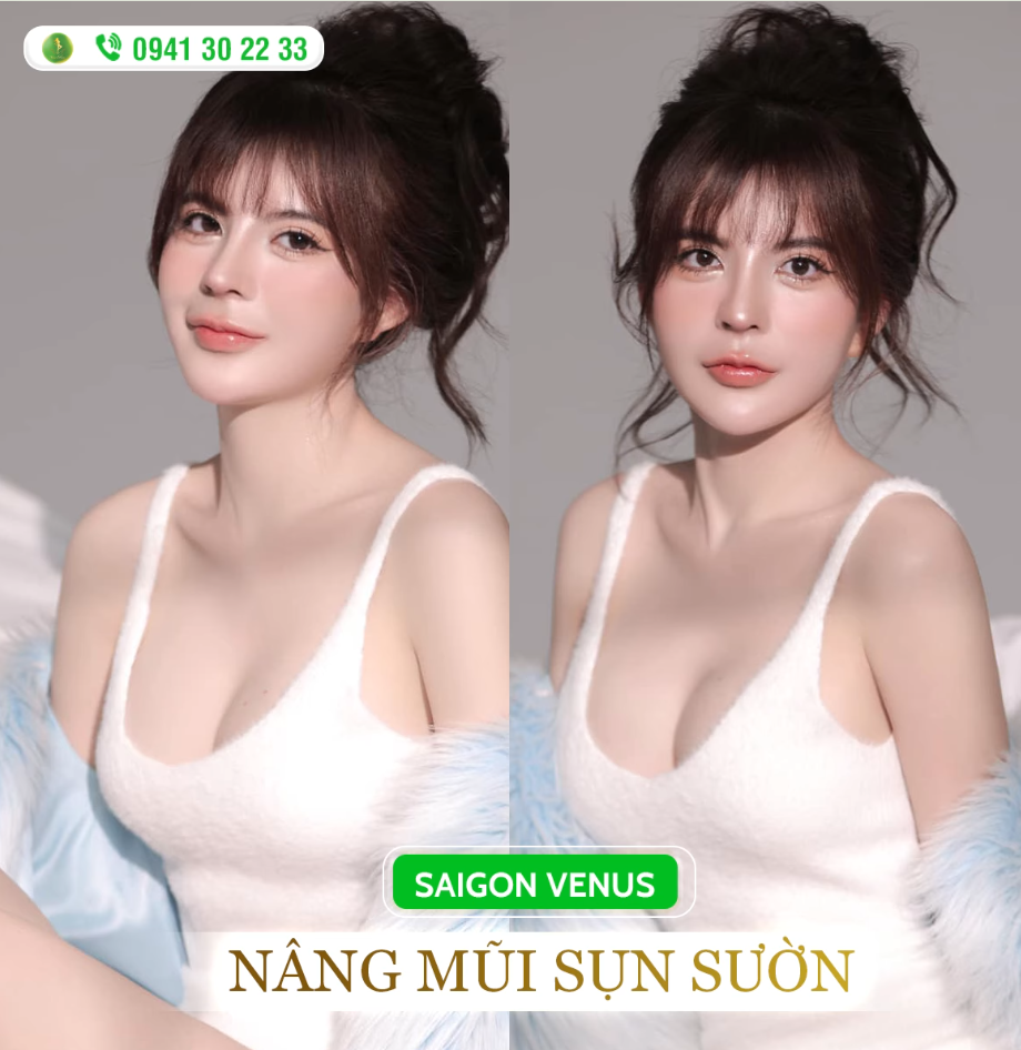 SỞ HỮU CHIẾC MŨI SỤN SƯỜN, THAY ĐỔI TOÀN DIỆN GƯƠNG MẶT