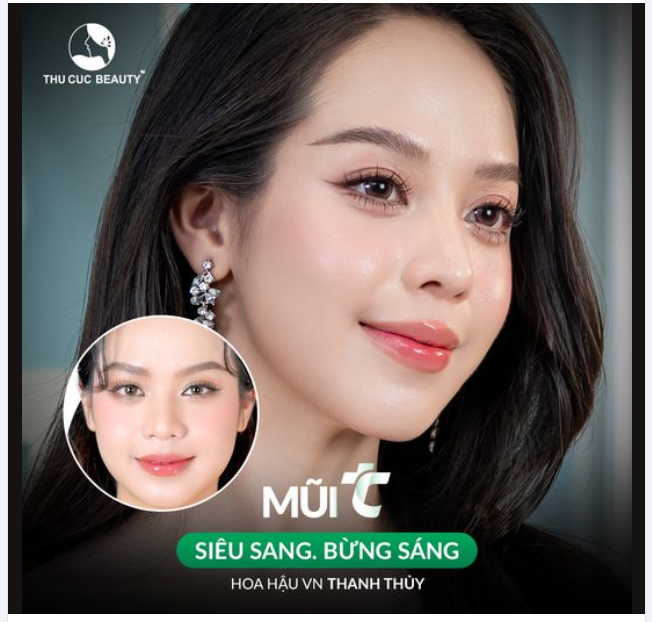 Sở hữu mũi xinh chuẩn Hoa hậu Thanh Thủy với ưu đãi tháng 9 Mũi TC 11.9Tr