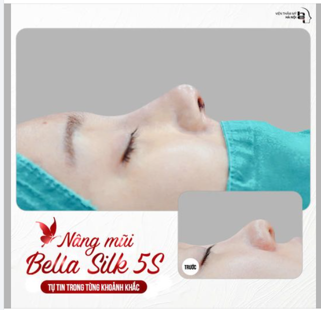 NÂNG MŨI BELLA SILK 5S - MŨI CÀNG ĐẸP, MẶT CÀNG XINH