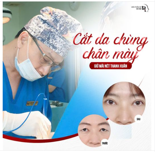Cắt da chùng chân mày KHÔNG KHÂU DA Giữ mãi nét thanh xuân