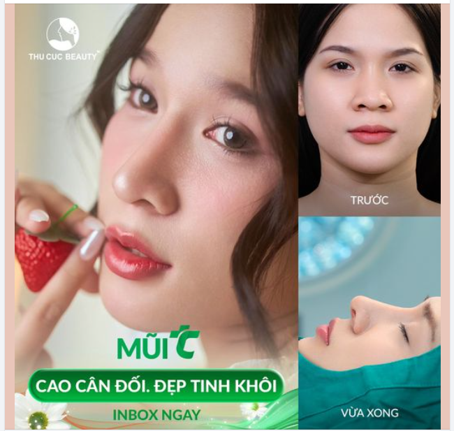 Khách hàng Lựa chọn nâng mũi để thăng hạng nhan sắc chỉ sau 30P với Mũi TC
