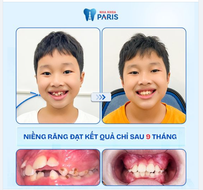 Tình trạng: Chen chúc, lộn xộn, khấp khểnh nặng