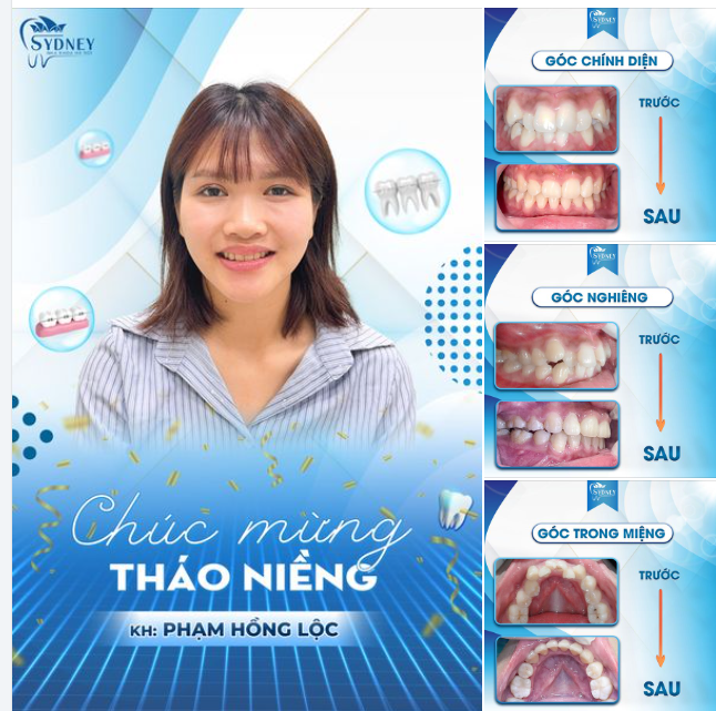 CHÚC MỪNG THÁO NIỀNG KH. PHẠM LỘC