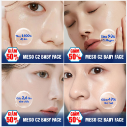 MESO C2 BABY FACE - KẺ THÙ LÃO HÓA, ĐÁNH BẠI TUỔI GIÀ