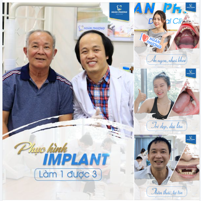 An toàn - Nhẹ nhàng - Bền chắc, làm 1 lần được hẳn 3 cái lợi