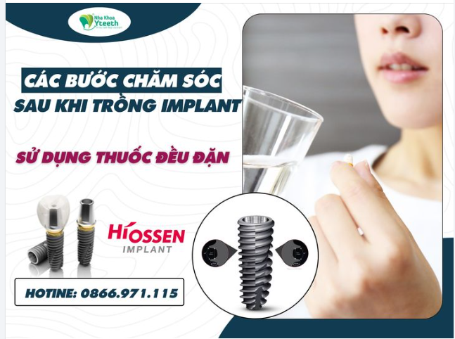 Các bước chăm sóc sau trồng răng - Sử dụng thuốc theo kê đơn của BS