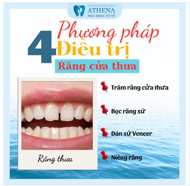 4 phương pháp điều trị răng cửa thưa