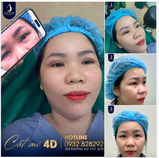 Sáng đầu tuần với ca mí 4D đẹp tự nhiên ngay sau khi làm