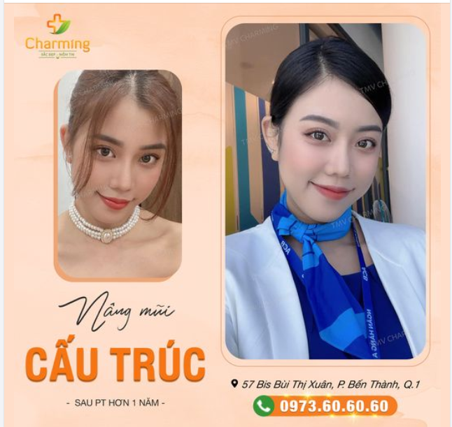 Nàng dù ở đâu, diện bộ đồ nào thì trông nàng vẫn vô cùng nổi bật với chiếc mũi cấu trúc cân đối, hài hòa.