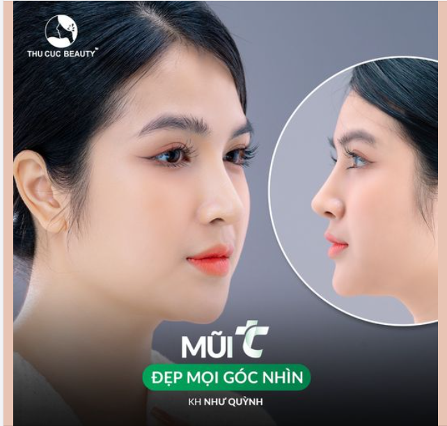 Muốn sở hữu góc nghiêng XINH - SANG - XỊN  Chọn ngay Mũi TC