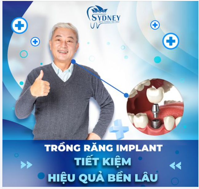 TRỒNG RĂNG TIẾT KIỆM - HIỆU QUẢ BỀN LÂU