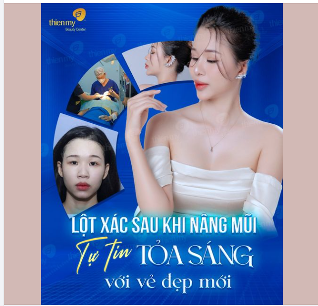 LỘT XÁC SAU NÂNG MŨI, TỰ TIN TỎA SÁNG VỚI VẺ ĐẸP MỚI 
